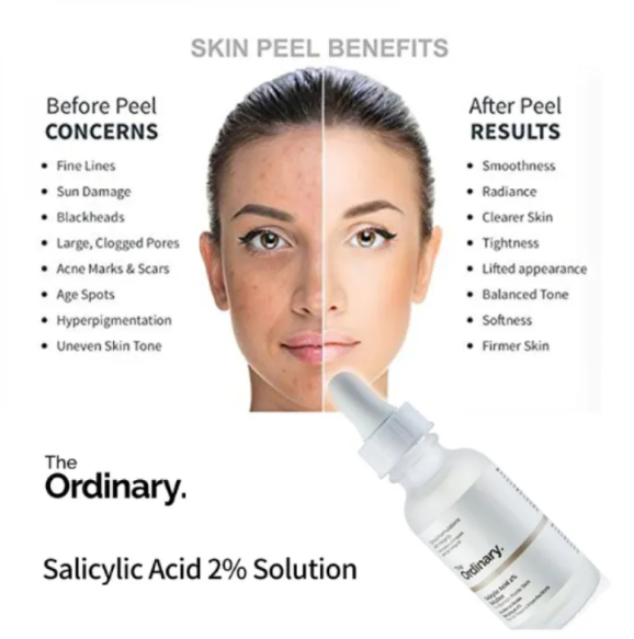 Special offer Niacinamide 10% + Zinc 1% Serum Oil Balance Whitening Moisturizer Original Essence Hydrating Skin Care 30mL