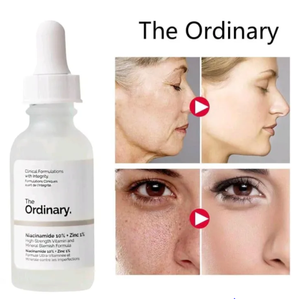 Special offer Niacinamide 10% + Zinc 1% Serum Oil Balance Whitening Moisturizer Original Essence Hydrating Skin Care 30mL