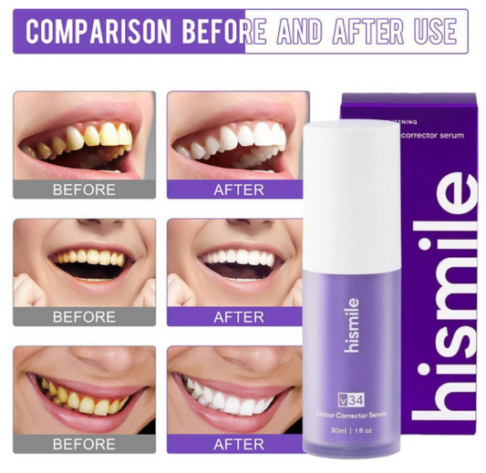 HiSmile Colour Correcting Serum for Teeth Whitening