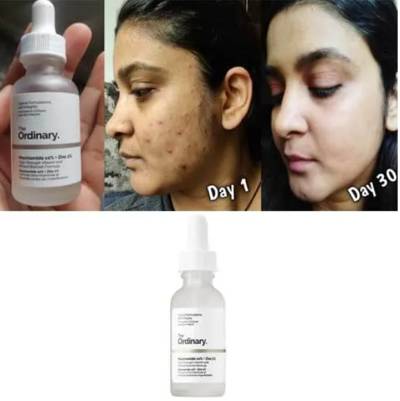 Special offer Niacinamide 10% + Zinc 1% Serum Oil Balance Whitening Moisturizer Original Essence Hydrating Skin Care 30mL